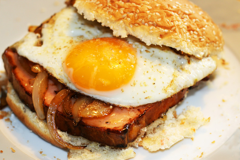 What is the best exercise for fatty (steatotic) liver?