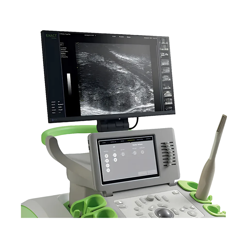 Micro Ultrasound Guided Transperineal Biopsy