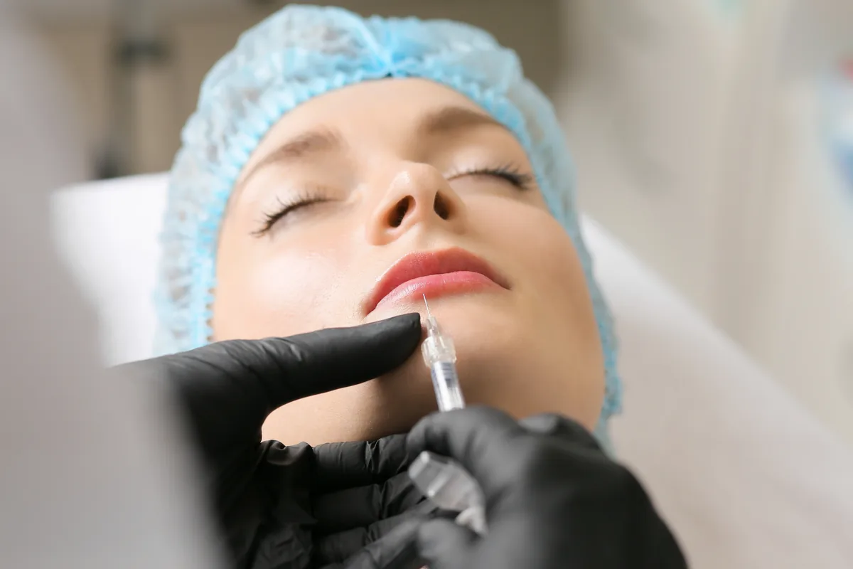 Dermal Filler Treatment