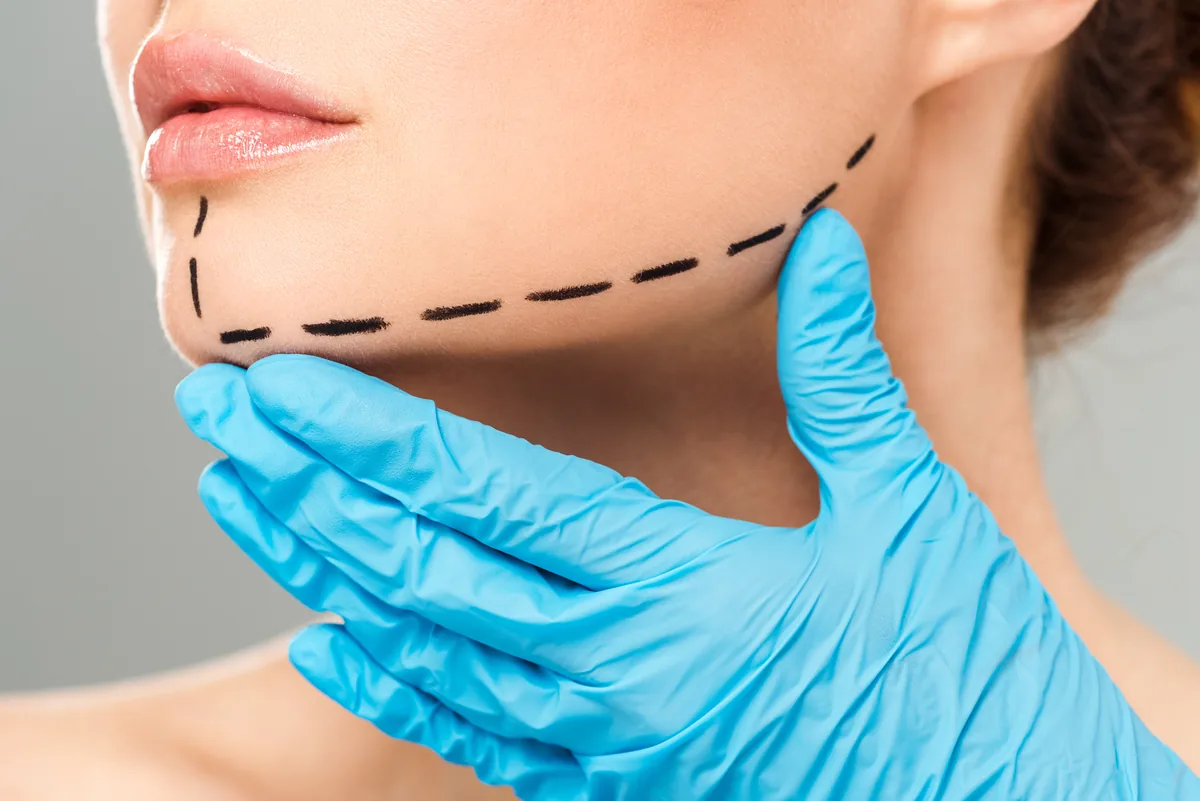 Lower Face And Neck Rejuvenation Surgery