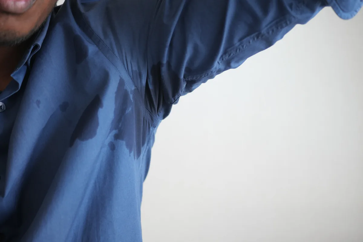 What is Hyperhidrosis?