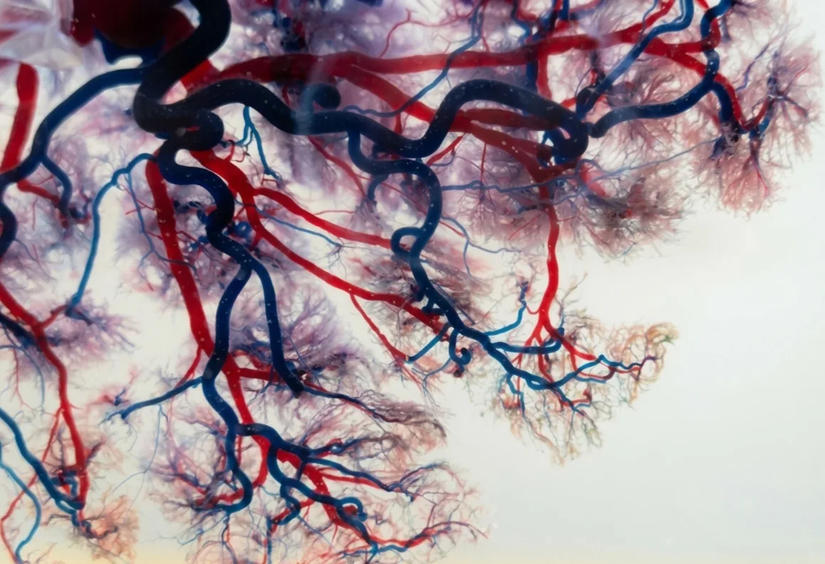 Vascular Disease: Types, Symptoms, and Treatment Options